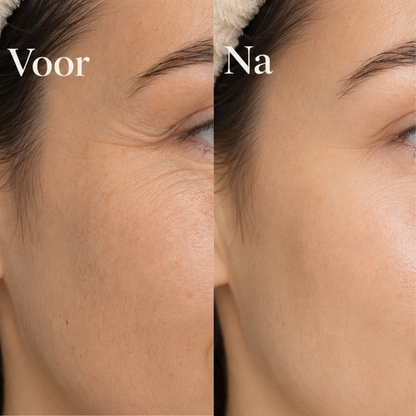 13.000 COLLAGEN &amp; BOOST+ package 
